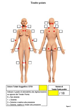 riconoscimento fibromialgia